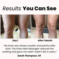 🌟 AuraLift™ Knee Recovery Device Auralift