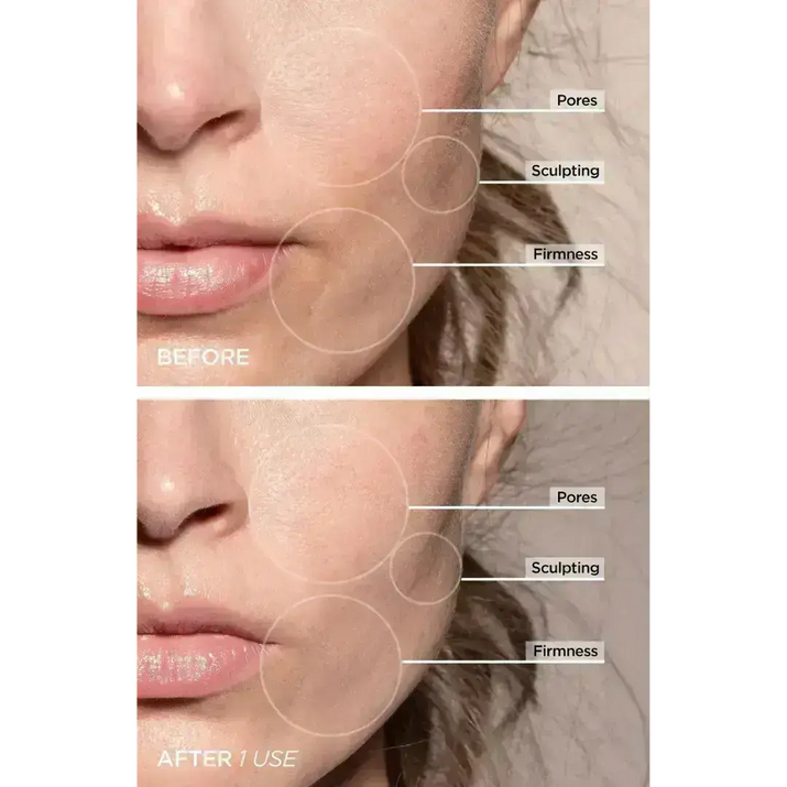 AuraLift - Facial Beauty Sculptor & Massager