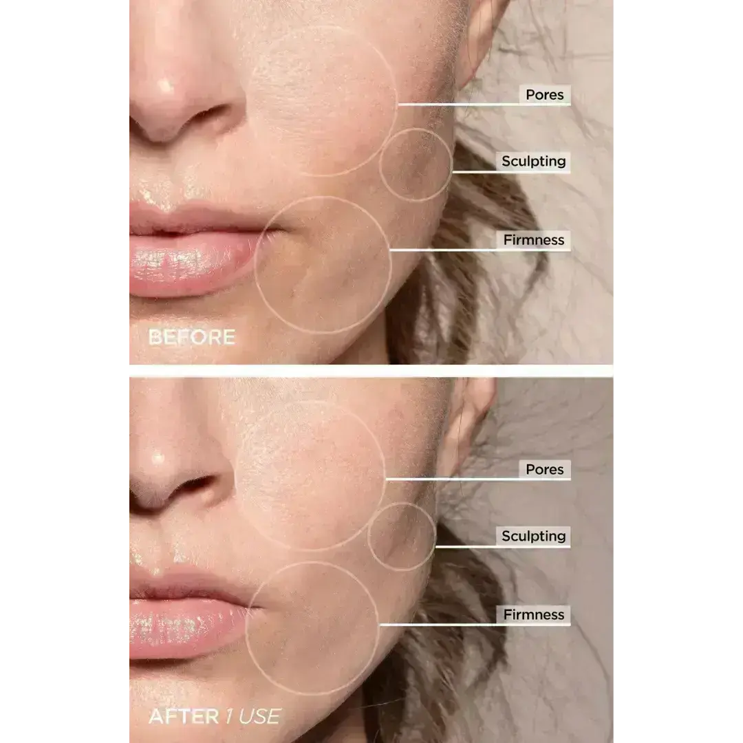 AuraLift - Facial Beauty Sculptor & Massager