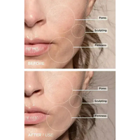 AuraLift - Facial Beauty Sculptor & Massager