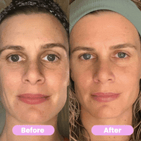 AuraLift - Facial Beauty Sculptor & Massager